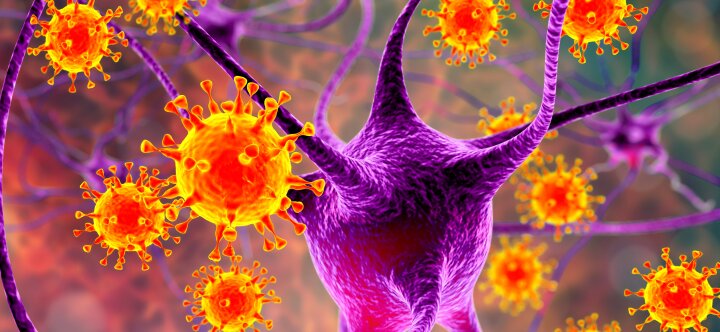 GeneProof™ Epstein-Barr Virus (EBV) MC PCR Kit